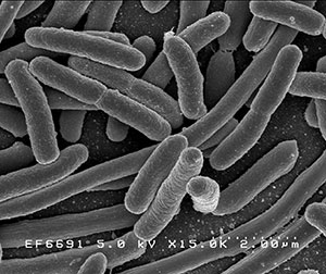 Credit: Rocky Mountain Laboratories, NIAID, NIH [Public domain], via Wikimedia Commons